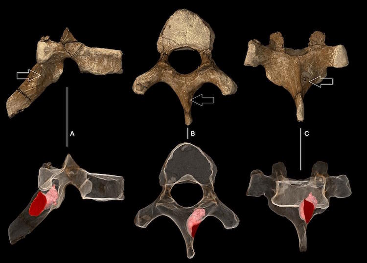 Genç Australopithecus sediba'nın altıncı torasik (göğüs) omuru. Üst sırada kemiğin yüzeyinin canlandırması görülüyor. Alt sırada ise, lezyonun sınırları pembeyle ifade edilen şekilde kemiğin iç kısmı ve hacmi görülüyor. A: Sağ yandan görüntü. B: Üstten görüntü. C: Arkadan görüntü. [F: Paul Tafforeau (ESRF)]