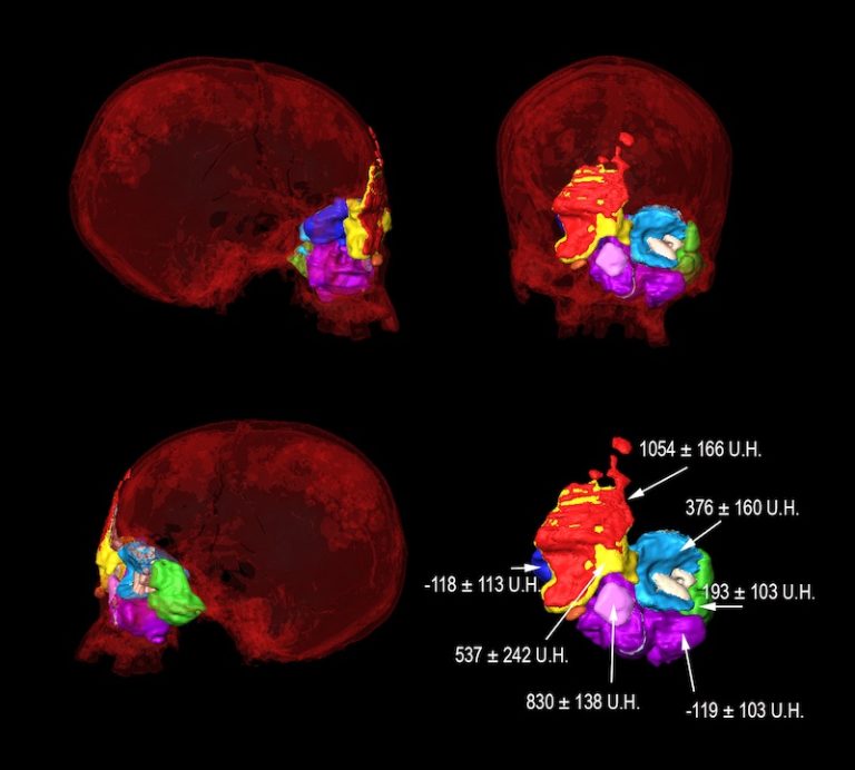 Niğde’de 9.000 Yıl Önce Sıvanarak Boyanmış Kafatasları Bulundu
