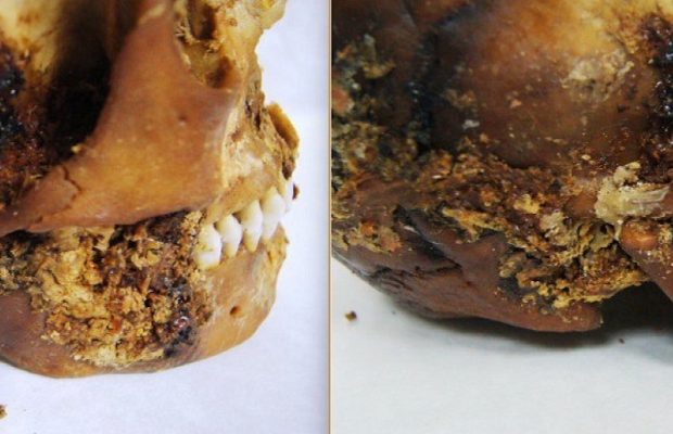 Mumyalanmış İskit Kadınının Çenesine ‘İlkel’ Protez Yapılmış